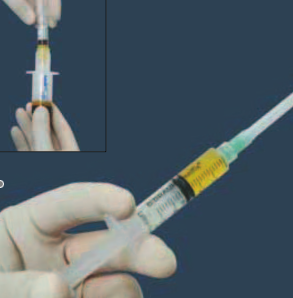 Syringe of platelet-rich plasma