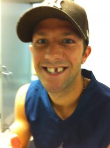Soccer player after losing a tooth
