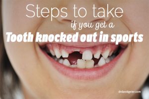 Steps to take if you have a tooth knocked out
