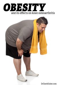 Obesity and arthritis of the knee