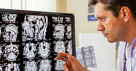 Doctor studies MRI of the brain for a concussion