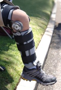 Hinged knee brace for a torn MCL