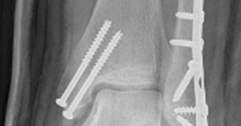 How to bet on football games