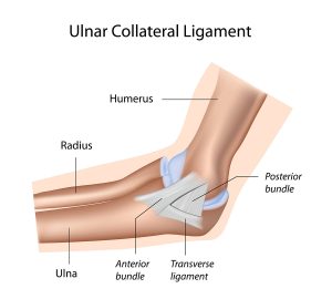 A UCL injury involves tearing of the ulnar collateral ligament of the elbow.